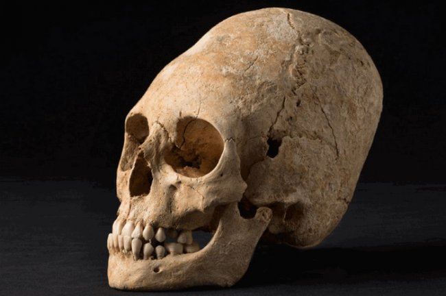 Красота требует жертв: 10 исторических примеров деформации черепов древними людьми