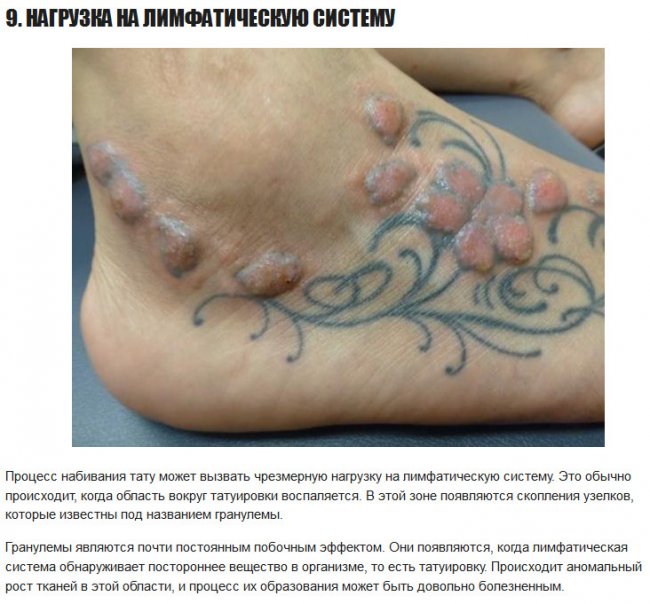 ТОП 10 негативных побочных эффектов татуировок