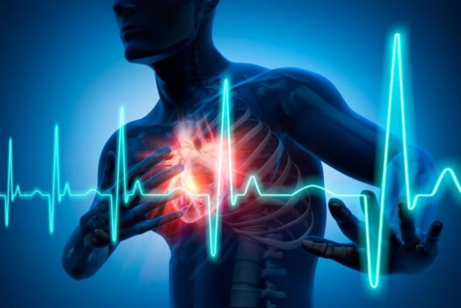 Как распознать сердечный приступ