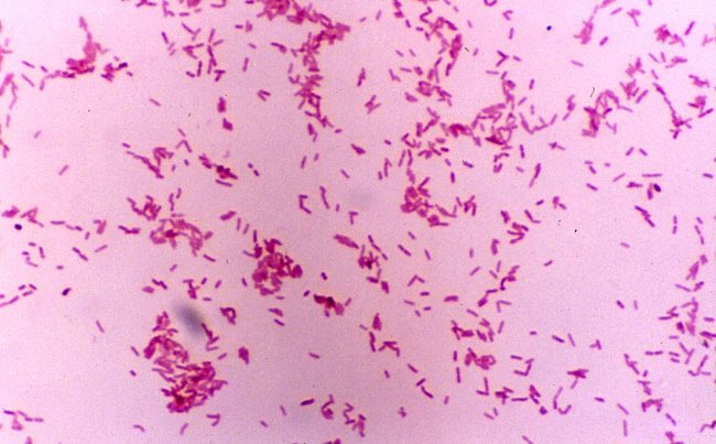 Заболевание людей, обусловленное Bordetella bronchiseptica: этиология, эпидемиология, патогенез