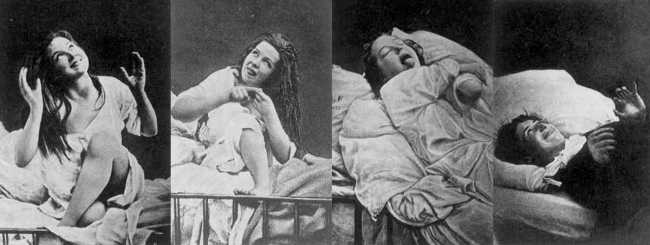 Лечение сексуальных расстройств у женщин в конце 19 столетия